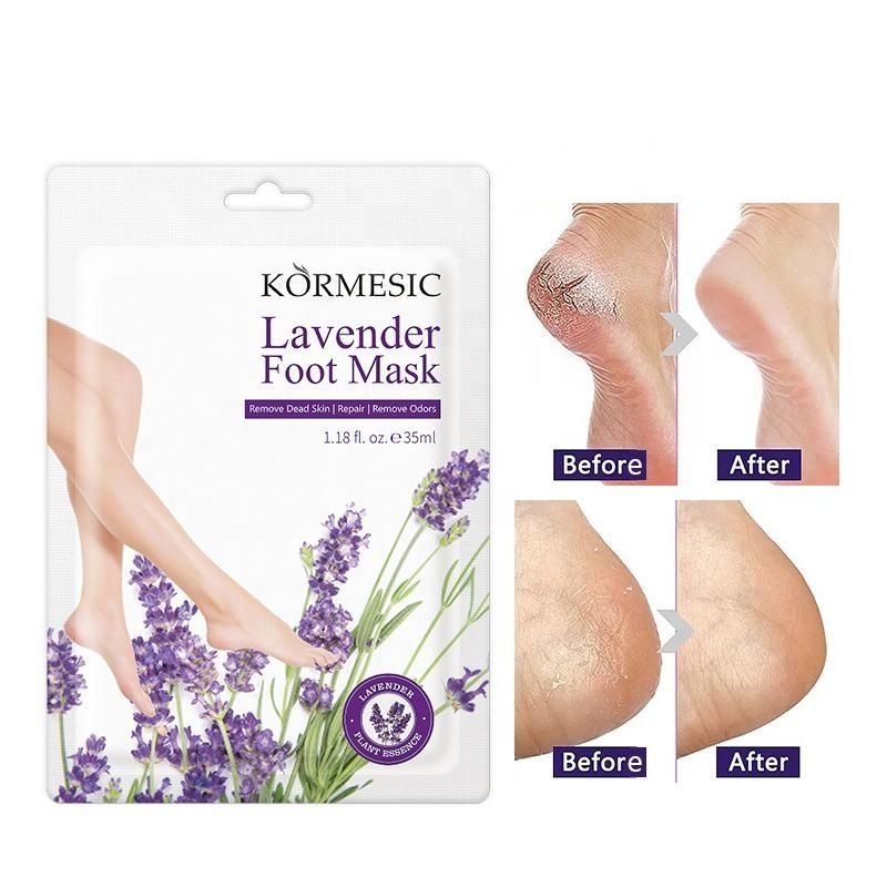 Lavender Foot Mask – Deep Repair & Spa-Like Softness at Home