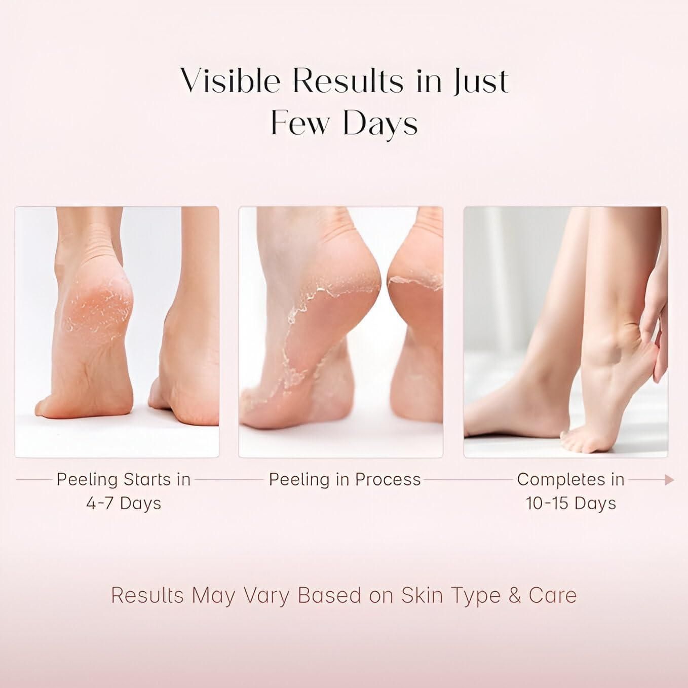 Exfoliating Foot Mask